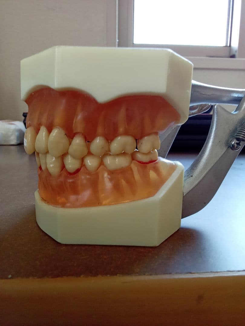 乳歯永久歯交換期模型、永久歯歯列模型